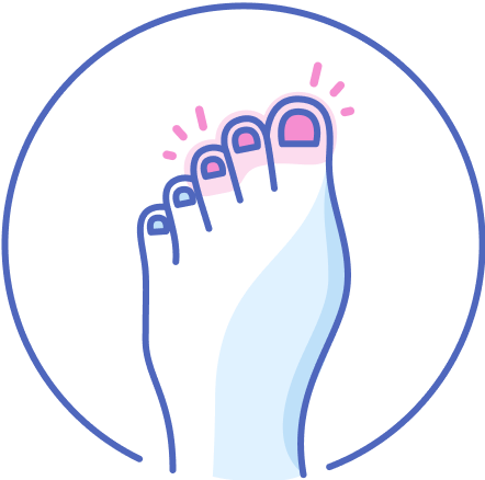 Paznokcie zmienione chorobowo